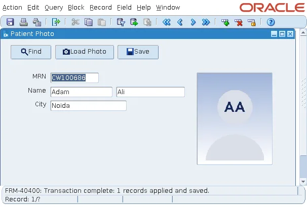 Oracle Forms image item showing a patient photo loaded with READ_IMAGE_FILE